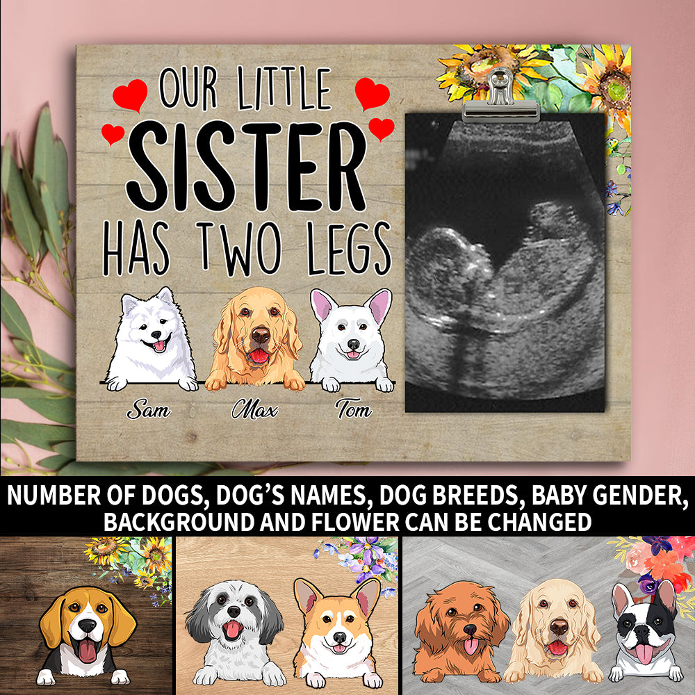 89Customized Our little brother/sister has two legs personalized photo clip frame