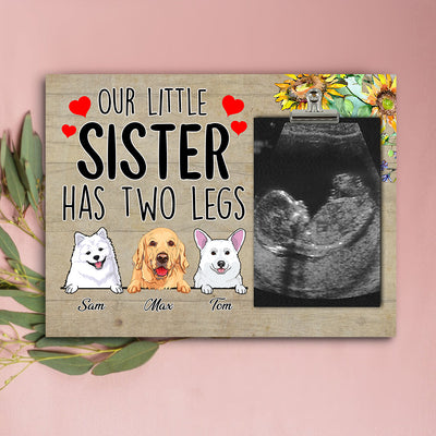 89Customized Our little brother/sister has two legs personalized photo clip frame